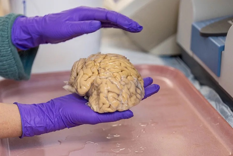 El cerebro de los ‘superancianos’ ofrece algunas claves de la eterna juventud El cerebro de los ‘superancianos’ ofrece algunas claves de la eterna juventud
