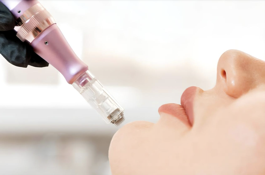 La revolución en el cuidado de la piel: Derma Pen, el secreto para una piel radiante La revolución en el cuidado de la piel: Derma Pen, el secreto para una piel radiante